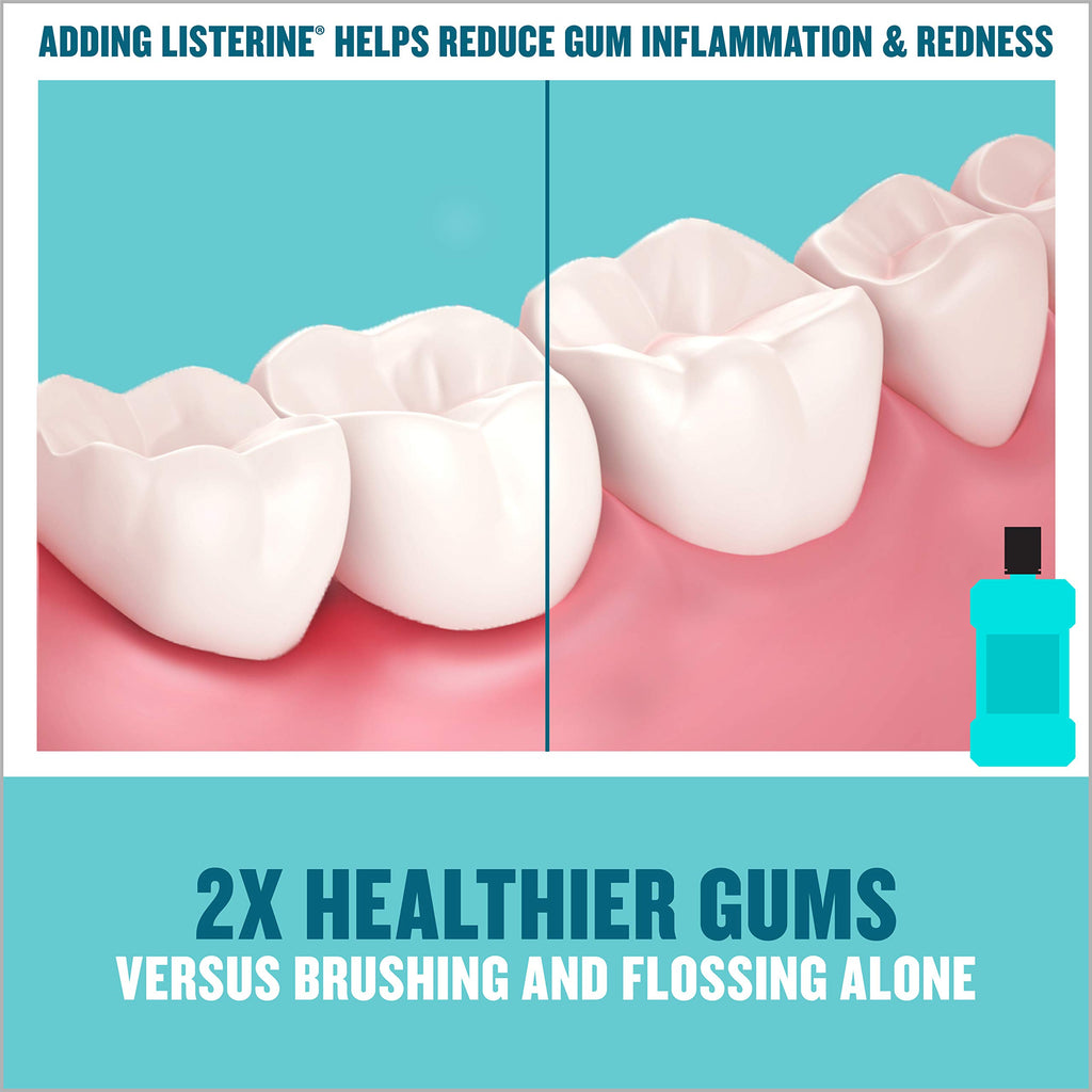 Listerine Ultraclean Intense Antiseptic Mouthwash + Whitening Protection*, Everfresh Technology to Help Fight Bad Breath, Gingivitis, & Plaque, Tartar Control Oral Rinse, Intense Mint, 1L, Pack of 2