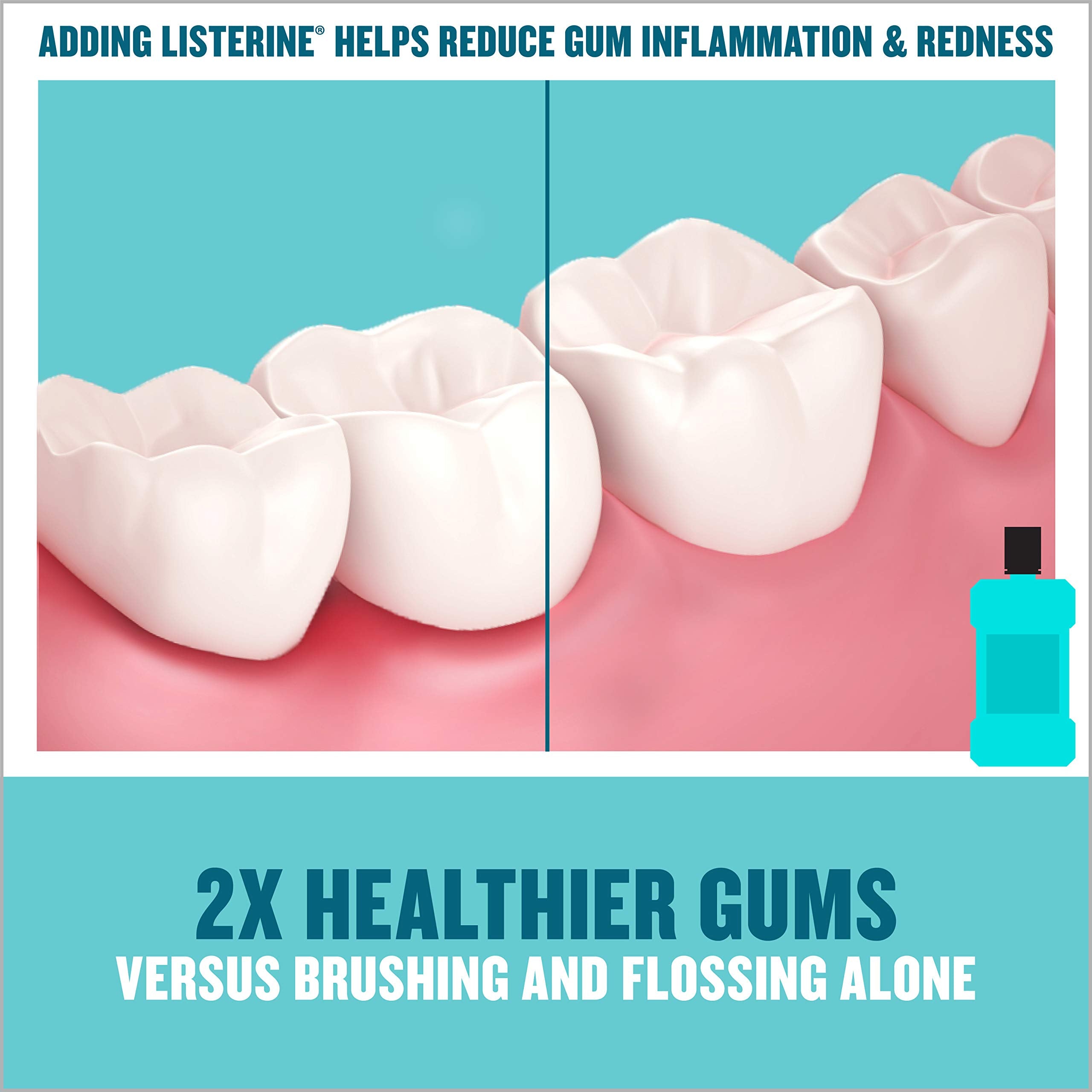 Listerine Ultraclean Intense Antiseptic Mouthwash + Whitening Protection*, Everfresh Technology to Help Fight Bad Breath, Gingivitis, & Plaque, Tartar Control Oral Rinse, Intense Mint, 1L, Pack of 2